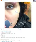 حمله افراد ناشناس به بازیگر زن ایرانی + عکس