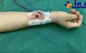 پرورش گوش غضروفی بر روی دست+ عکس