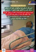 عکس/ مداح معروف مورد عمل جراحی قرار گرفت