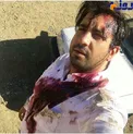 عکس دیده نشده از خواننده ایرانی غرق در خون