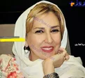 ظاهر تغییر یافته خانم بازیگر مشهور + عکس