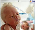 موهای عجیب و غریب نوزاد تازه متولد شده سوژه شد/عکس