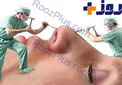 با عوارض جراحی بینی آشنا شوید