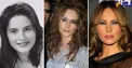 جراحی‌های پلاستیک متعدد ملانیا ترامپ + عکس