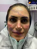 تصویری غم انگیز از وضعیت پرستار ایرانی در روزهای کرونایی