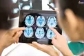 سردرد عجیب یک زن به خاطر جولان یک کرم در سرش!+عکس