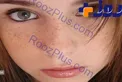 درباره لکه های قهوه ای پوست بیشتر بدانیم