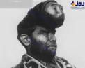 غده عجیب بر روی سر این مرد او را ثروتمند کرد/عکس