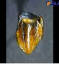 کشف دندان ۱۰ میلیون ساله در آلمان!+عکس