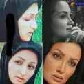 افشای عکسی از چهره متفاوت خانم بازیگر پیش از عمل جراحی