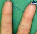 خانواده هایی که اثر انگشت ندارند!+عکس
