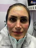 عکس/ رد ماسک بر صورت پرستار ایرانی