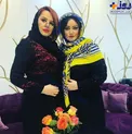 چهره باورنکردنی خانم بازیگر پس از جراحی لاغری+عکس