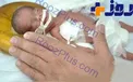 تولد نوزادی به اندازه کف دست +عکس