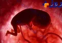 حکم شرعی سقط جنین ناقص‌الخلقه/ کورتاژ در چه مواردی جایز است؟