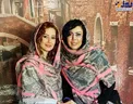 تغییرات ظاهری خانم بازیگر درپی جراحی های زیبایی+عکس