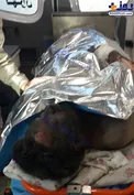 قطع دست و سوختگی ۷۰ درصد جوان ۳۰ ساله به دلیل انفجار مواد محترقه/عکس