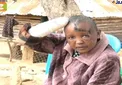 قطع كردن دست زن توسط شوهر به دليل بچه دار نشدن+عكس