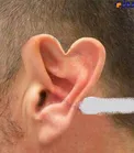 بعد از جراحی زیبایی گوش الاغی حالا نوبت به مدل قلبی رسید! +عکس