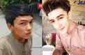 جراحی های پسر جوان برای این که شبیه شخصیت های کارتونی شود+ عکس