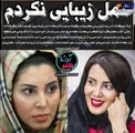 توضیح خانم بازیگر در مورد عمل زیبایی اش+عکس