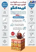 اینفوگرافیک/ شباهت علائم کرونا و تب کریمه کنگو