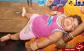 کودک 2 ساله‌ای که همانند مردان سبیل دارد+عکس