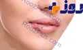 چرا گوشه لب ترک میخورد؟