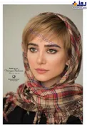 تغییرات ظاهری بیش از اندازه خانم بازیگر/عکس