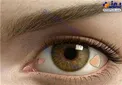 عمل لاكچری طلايی چشم برای پولدارهای تهرانی +عكس