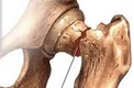 معجونی برای جلوگیری از ابتلا به 