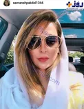 تغییر چهره خانم بازیگر پس از ازدواج/ عکس