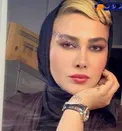 خالکوبی سوزن قفلی روی دست خانم بازیگر/عکس