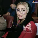تغییرات ظاهری محسوس خانم بازیگر مشهور/عکس