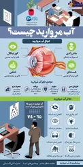اینفوگرافیک/ آب مروارید چیست؟