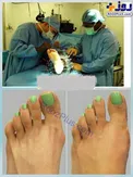 عجیب ترین عمل جراحی زیبایی؛ سیندرلایی کردن پا+عکس