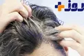 معرفی محلولی جادویی برای رفع سفیدی تارهای مو