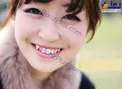 مُد جدید زنان برای کج کردن دندان+عکس