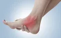 مهمترین دلایل افتادگی مچ پا و انگشتان چیست؟