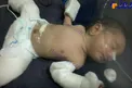 نوزادی که باردار به دنیا آمد!+ عکس