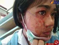 عکس/ دختری که خون گريه مي‌کند!