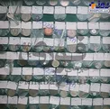 چیزهای عجیبی که از شکم کودکان در بیمارستان درآمده/عکس
