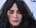 عکس/گریم فوق العاده متفاوت بهنوش طباطبایی با صورتی زخمی