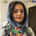 چهره کاملا تغییر یافته خانم بازیگر در جدیدترین سلفی