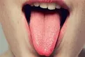 زبان‌تان به شما چه هشدارهایی درباره سلامتی تان می دهد؟