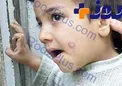 زخمی که یک سال روی بدن می ماند!