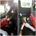 عکس+16/ نوجوانی که در حوادث چهارشنبه سوری انگشتانش را ازدست داد