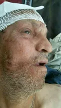 تصویری از سردار حاج احمد غلامی که در سوریه مجروح شده است