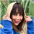 چهره عجیب و ترسناک بهنوش بختیاری بعد از عمل زیبایی/عکس