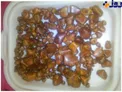 خارج کردن ۲۵۰ قطعه سنگ از کیسه صفرای یک بیمار +عکس